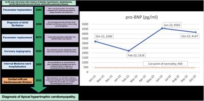 Case report: Diagnosis of apical hypertrophic cardiomyopathy that escaped clinical and echocardiographic investigations for twenty years: Reasons and clinical implications